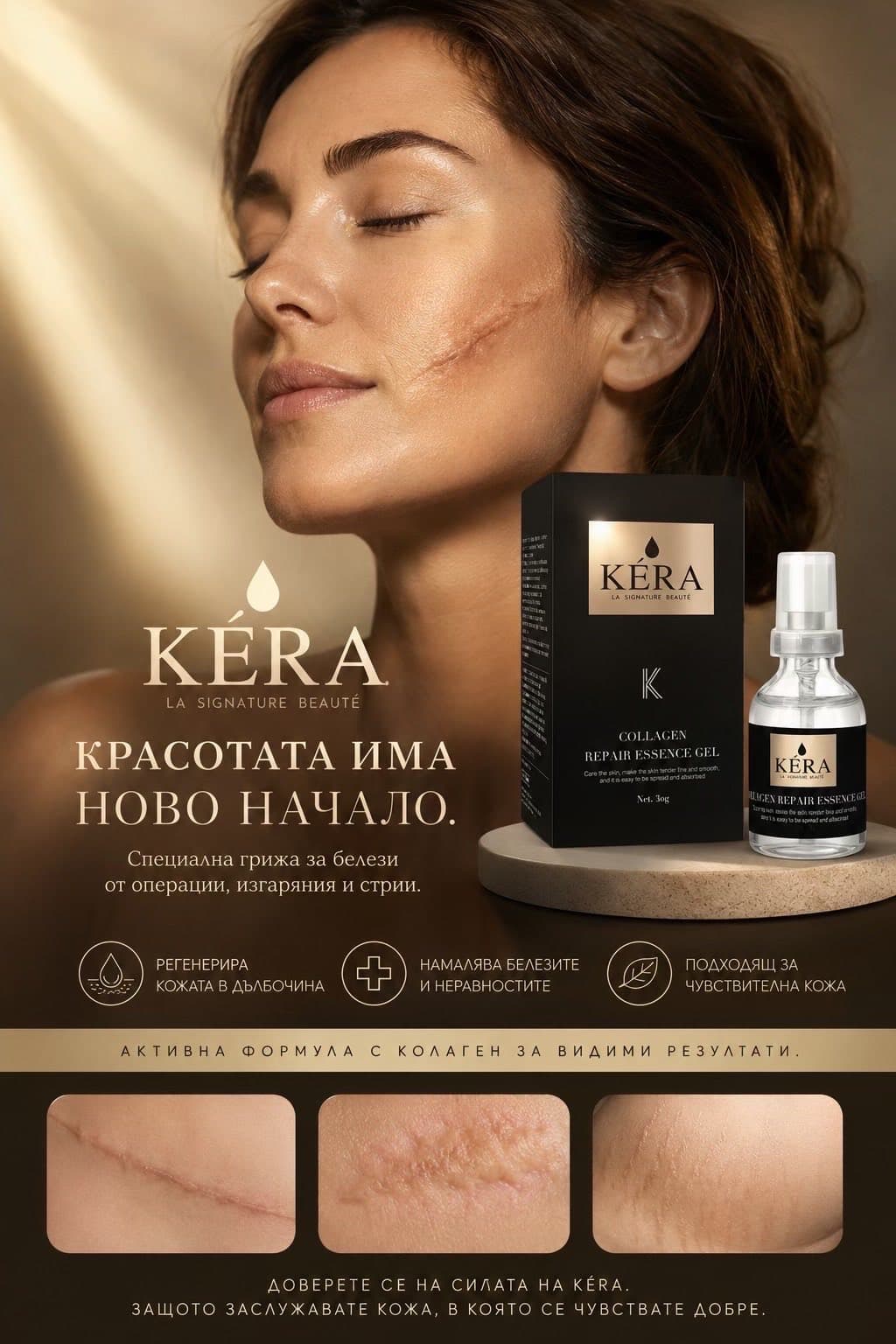 KÉRA грижа за белези и стрии