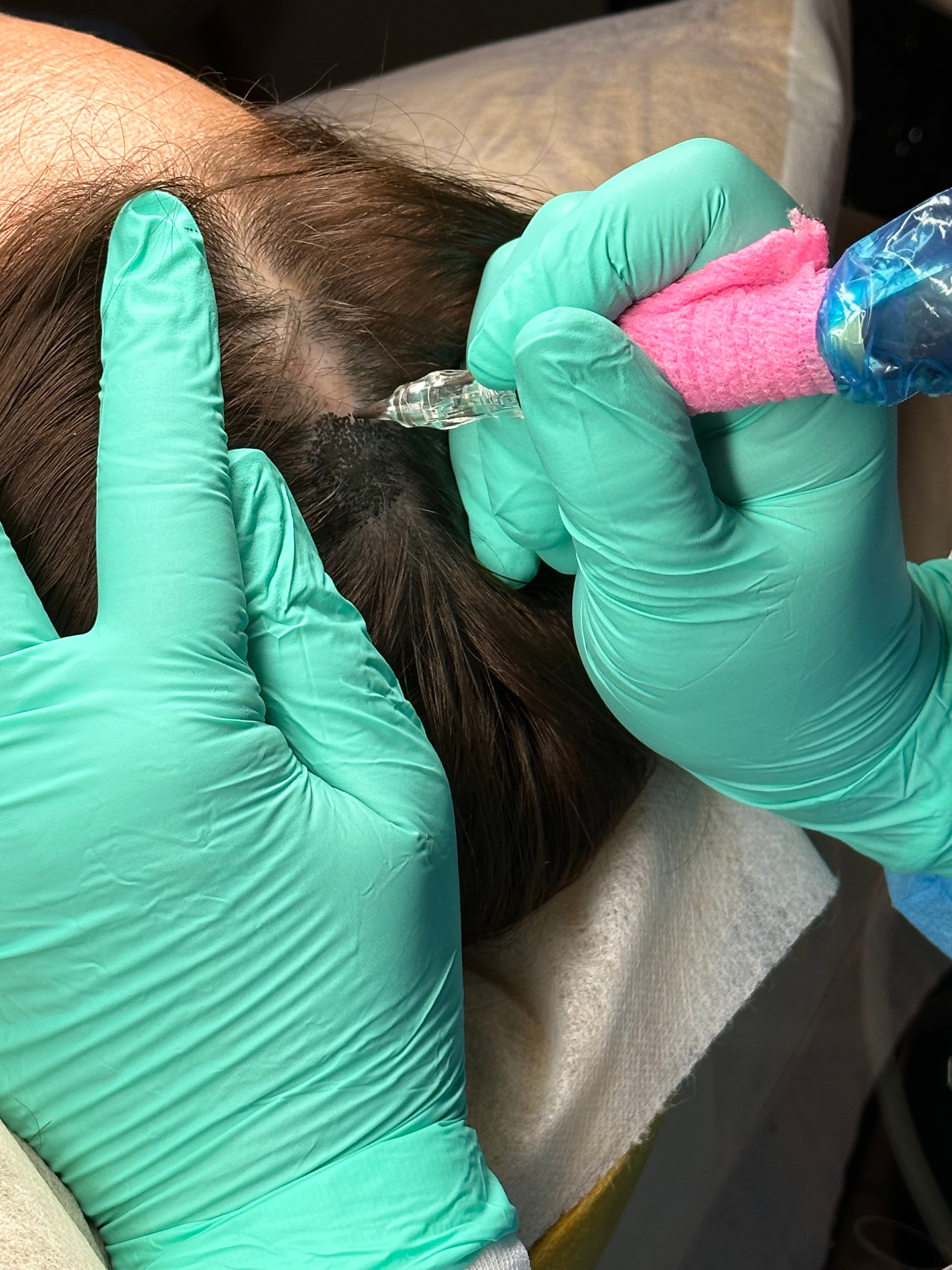 scalp pigmentation training
