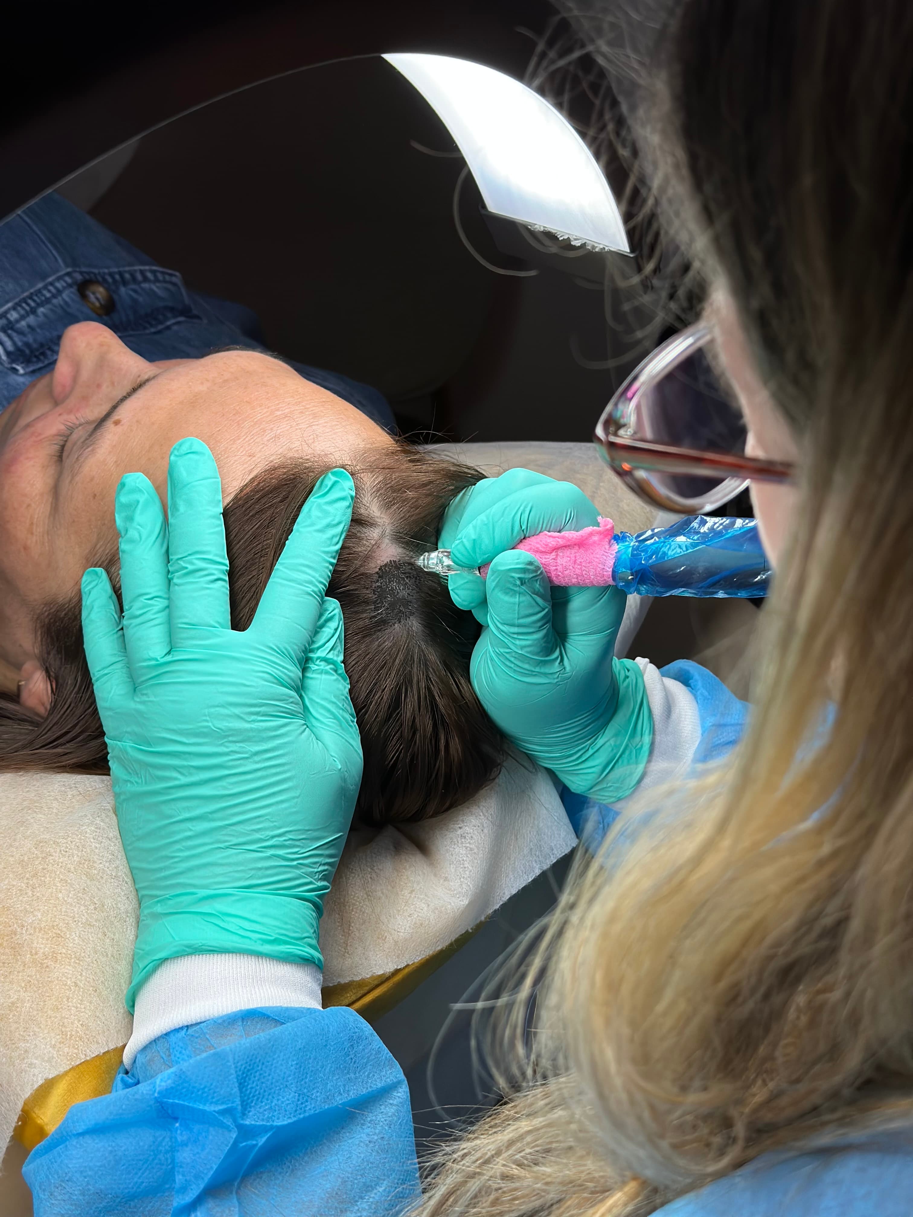 scalp pigmentation training